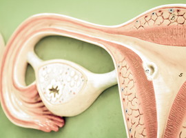 Traitement d’entretien à base de niraparib en cas de récidive de cancer de l’ovaire sensible au platine