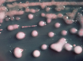 Antibacteriële resistentie en de “tragedie van het gemeenschappelijke bezit”