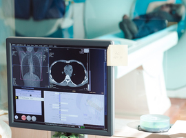 L'INAMI réclame 13,5 millions d'euros aux hôpitaux pour des scans IRM non agrées