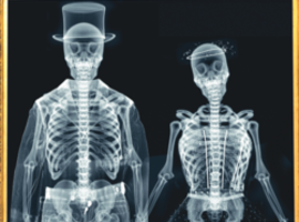 “Elke Belg ondergaat jaarlijks een radiografisch onderzoek”
