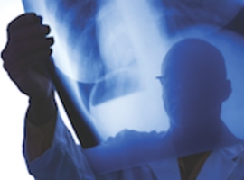 Hoe moet een radiologieverslag eruitzien?