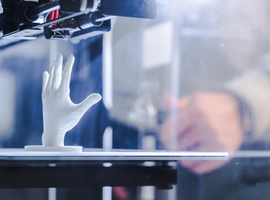 UZ Gent wil 3D protheses printen