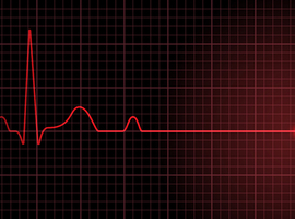 Insuffisance cardiaque: associations et patients tirent la sonnette d'alarme