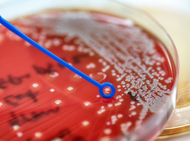 UCL-onderzoekers identificeren molecule in strijd tegen ziekenhuisbacterie