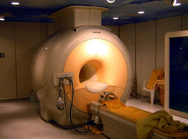 De abnormale ophoping van natrium in de hersenen gemeten door een MRI toont de evolutie van multiple sclerose aan