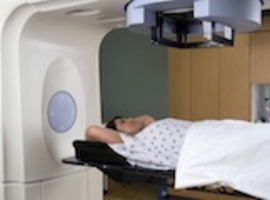 Kans op ischemische hartziekte na radiotherapie voor borstkanker