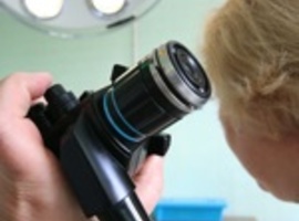 Screenen naar colorectale kanker en sterftereductie