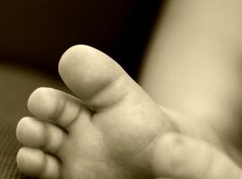Affections du pied chez l’enfant et l’adolescent (2)