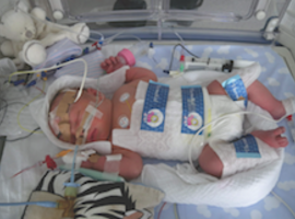 Hypothermie thérapeutique modérée dans le traitement de l’asphyxie périnatale des nouveau-nés à terme