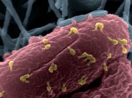 Behandeling met bacteriofagen: quid faagtherapie?
