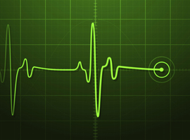 Tachycardie et fibrillation ventriculaires aux urgences: diagnostic et traitement