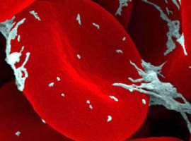De behandeling van hemartrose bij hemofiliepatiënten (deel 9: multidisciplinaire medische follow-up)