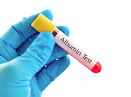 Is het serumalbuminegehalte een nuttige marker bij een ACS?