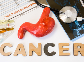 Le trastuzumab-deruxtecan dans le cancer gastrique HER2+ précédemment traité
