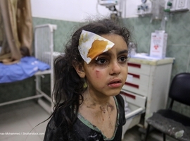 Plus de 20.000 blessés encore à Gaza (MSF) 