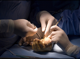 Technieken voor microvasculaire reconstructies bij orthopedische chirurgie en traumatologie