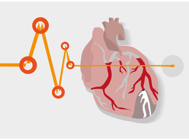 Risque cardiovasculaire lié aux immunomodulateurs chez les patients atteints de polyarthrite rhumatoïde