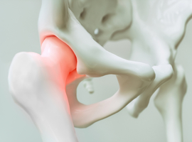 L’hypoxie protège le cartilage contre l’arthrose: la protéine DOT1L joue-t-elle un rôle dans ce processus?