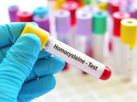 L’homocystéine et le cycle de la méthylation: pathologies liées