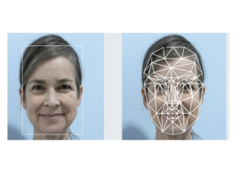 Un algorithme basé sur une photo du visage pourrait prédire la survie en oncologie