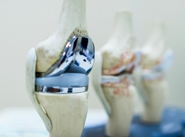 Reprise de prothèse totale de genou: connaissances actuelles relatives aux différents types de prothèse