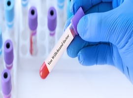 Maladie de von Willebrand: Un casse-tête diagnostique qui demande un décryptage attentif des symptômes