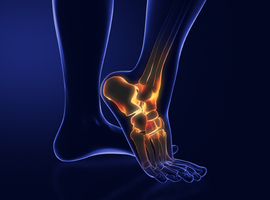 Klein gewricht, grote uitdagingen