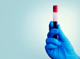 Eerste bloedonderzoek naar PFAS bij kinderen jonger dan twaalf