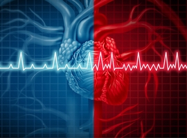 Quels bénéfices à long terme de la CRT dans l’insuffisance cardiaque?