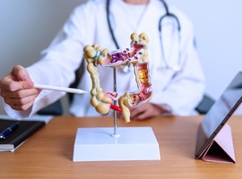 Un nouveau standard est né pour les cancers colorectaux