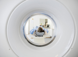 Ook scans in ziekenhuizen gaan geregeld gepaard met ereloonsupplementen 