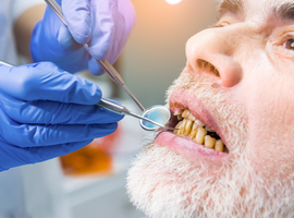 Le conseil des ministres approuve les quotas de dentistes pour 2028