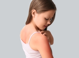 Zonneallergie bij kinderen: van zonnebrand tot diagnostische valkuilen