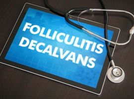 Une prise de position sur les maladies du cheveu