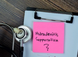 Hidradénite suppurée: il faut intégrer le concept d’atteinte cumulative