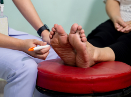 Le pied de Charcot ou l’ostéo-arthropathiediabétique du pied 