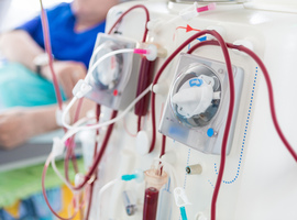 Les patients dialysés, une cible privilégiée  pour le Covid-19 
