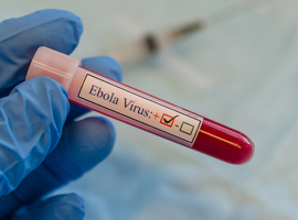 Ebola : L'IMT d'Anvers débute une étude sur les vaccinations de rappel en octobre