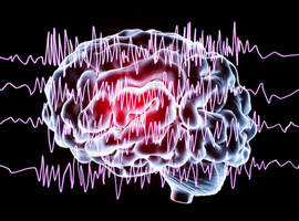 Epilepsie: naar een steeds fijnere behandeling