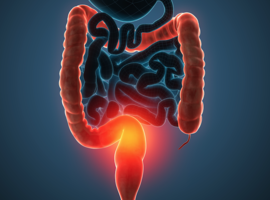 Une molécule naturelle pour venir soutenir un traitement contre le cancer du colon (ULg)