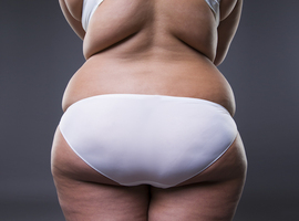 L’obésité: vers un changement de paradigme