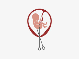 Dépénalisation de l'avortement - Une prochaine majorité impliquera des accords contraignants sur les sujets éthiques (CD&V)