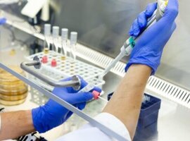 UAntwerpen en KU Leuven hebben nieuwe spin-off die focust op vrouwelijke gezondheid