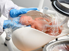 AquaWomb : vers un système extra-utérin pour les naissances extrêmement prématurées