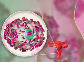 Het ISALA-project: nieuwe inzichten in het vaginale microbioom