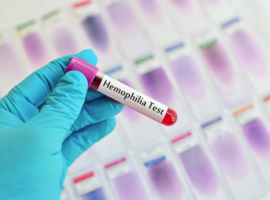 Thérapie génique  pour l’hémophilie B