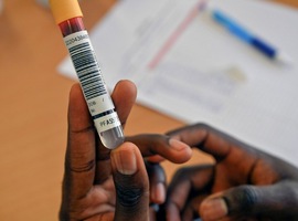 PFAS: une nouvelle campagne de dépistage sanguin va débuter en Wallonie