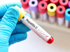Les virus de l'hépatite font encore 3.500 morts par jour, s'alarme l'OMS