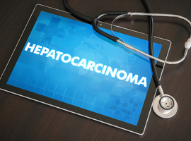 Hépatocarcinome: REACH et REACH2 vont dans le même sens