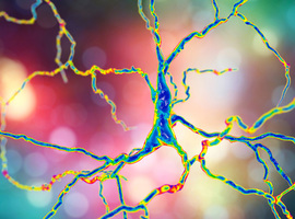 Des médecins annoncent une avancée majeure dans le traitement de la maladie de Huntington